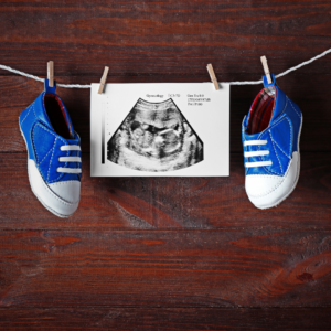 Ultrasound with blue baby shoes on clothesline- Baby Healed of Down Syndrome Blog